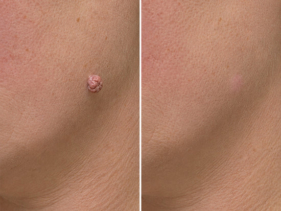Before and after - Mia Aji